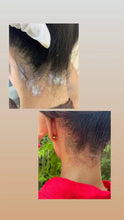 Psoriasis & Ekzem Salbe 60 gramm
